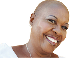 African American woman with Alopecia