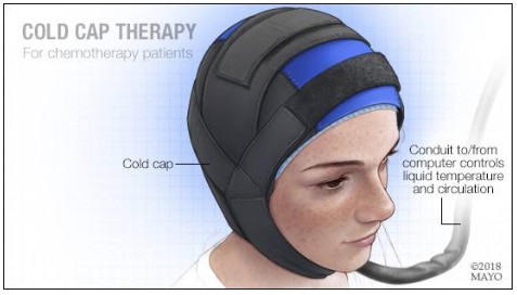 Cold Cap Therapy