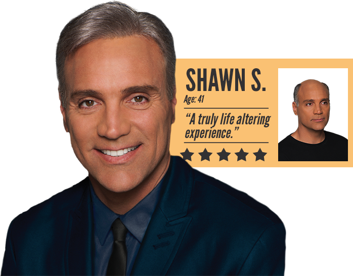 Men's Hair Loss Before & After - HPIHair Partners