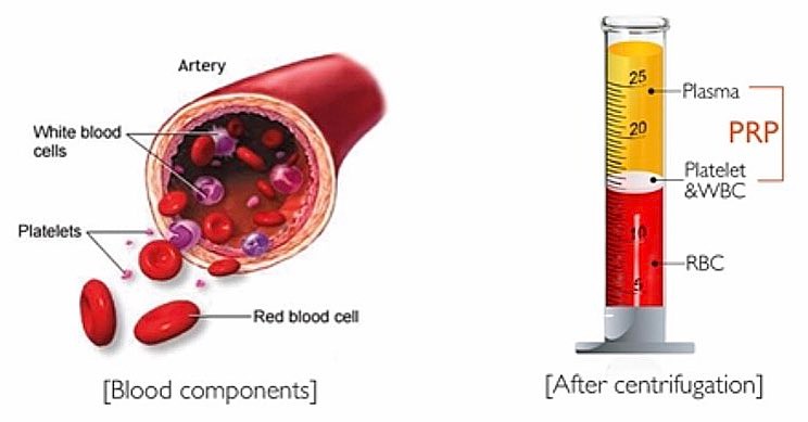 Blood Components used in PRP