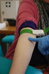 A woman is getting a blood test for Alopecia DX in a doctor's office.