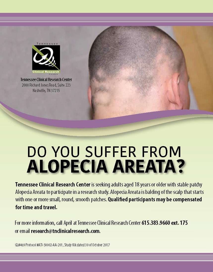 Alopecia Areata Trial Flyer