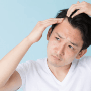 Alopecia: Genes, Hormones, and More Causes of Hair Loss