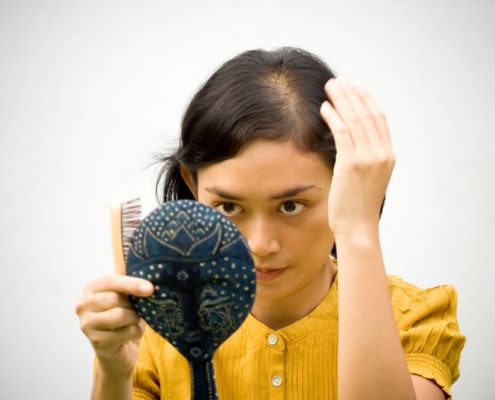 Solutions for hair loss