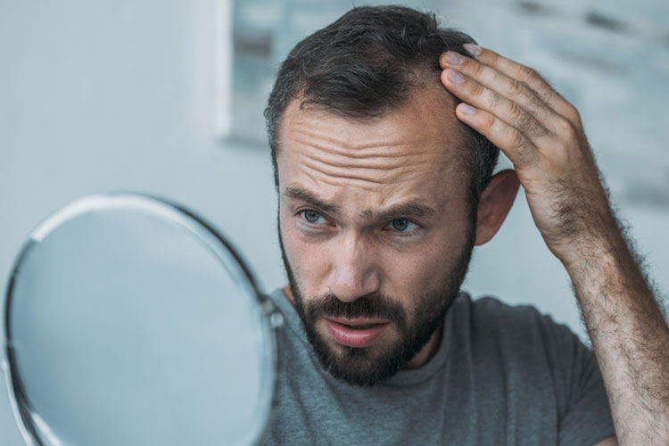Lupus Hair Loss Thinning Hpihair Nashville Tn