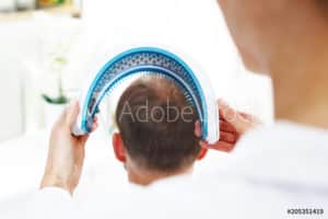 A man is combing his hair with a comb to address hair thinning.