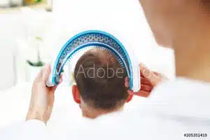 A man is combing his hair with a comb to address hair thinning.