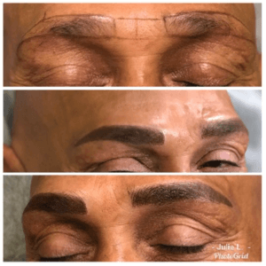 Men's Brow reconstruction for more masculine, defined brows