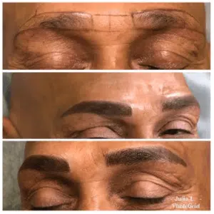 Before and after pictures showcasing a man's brow enhancement.