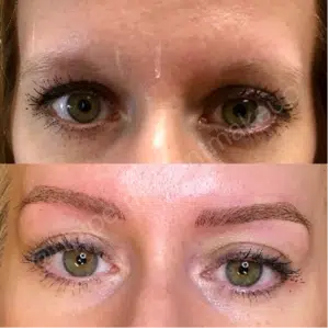 Woman's eyebrows after brow and eye enhancement treatment.