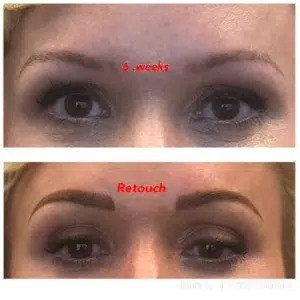 A before and after photo of brow enhancement through eyebrow tattooing.