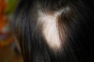 A close up of a woman's hair depicting signs of alopecia.