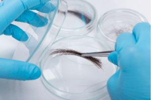 An individual is delicately preserving a strand of hair in a glass container, as part of the process in developing a customized treatment plan for hair restoration.
