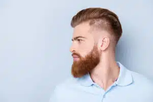 A men with a beard and hair loss.