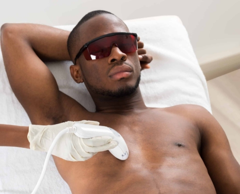 Man Receiving Laser Hair Removal On His Chest Scaled