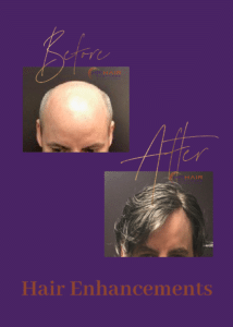 Before and after photos showcasing hair enhancements for men.