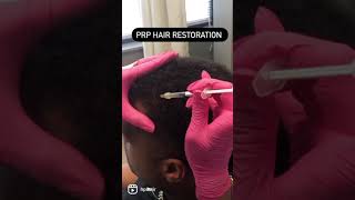 PRP Hair Restoration Injection