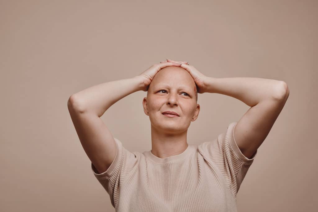 Women with Alopecia Totalis