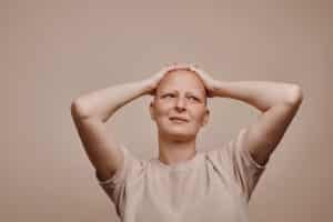 Women with Alopecia Totalis