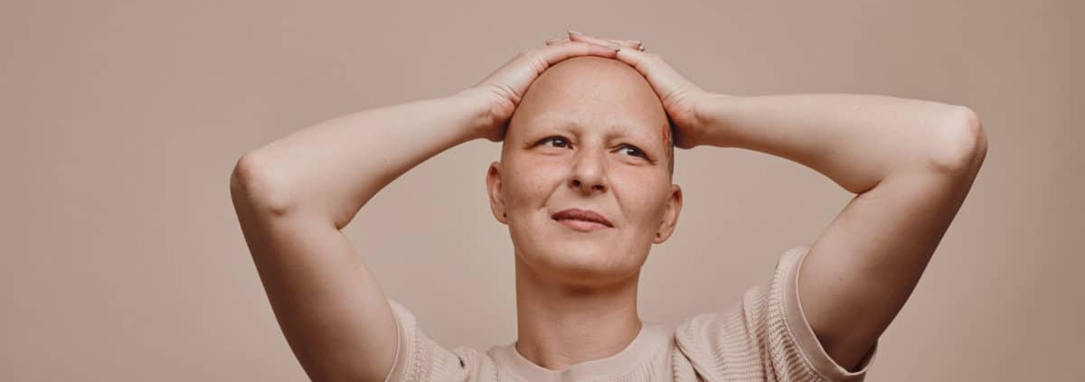 Women with Alopecia Totalis