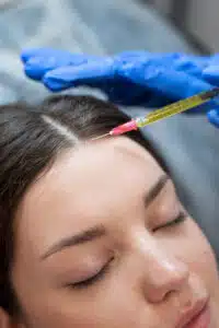 Close up of a young Woman getting PRP injection