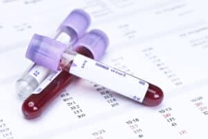 Several vials blood samples