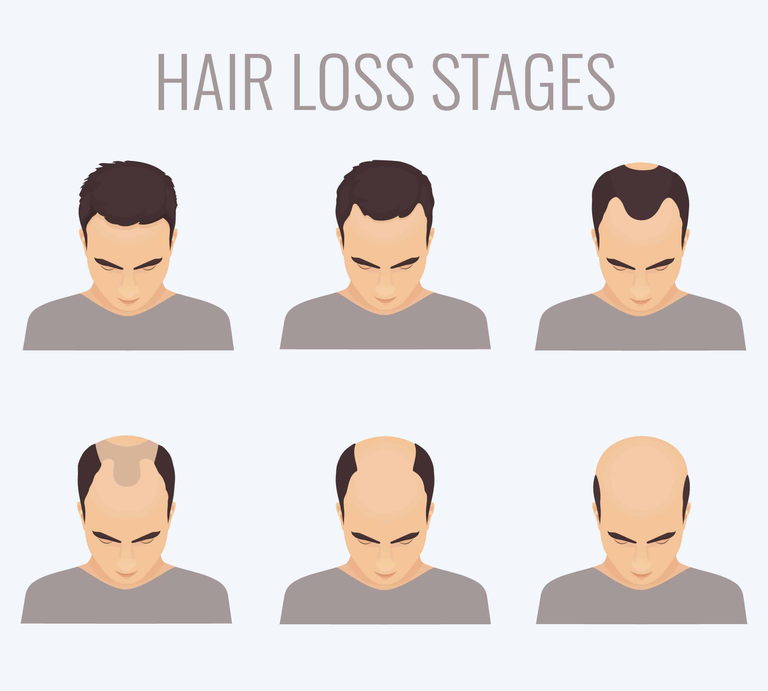 Hair Today, Gone Tomorrow: A Closer Look at the Reasons Behind Hair Loss