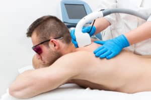 Man Receiving Laser Hair Removal On His Back