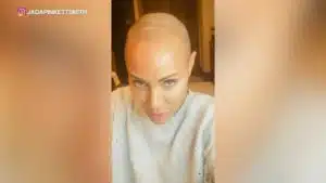 Jada Pinkett Smith Alopecia Instagram
