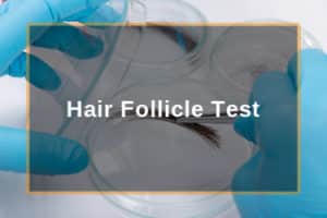Hair follicle test photo