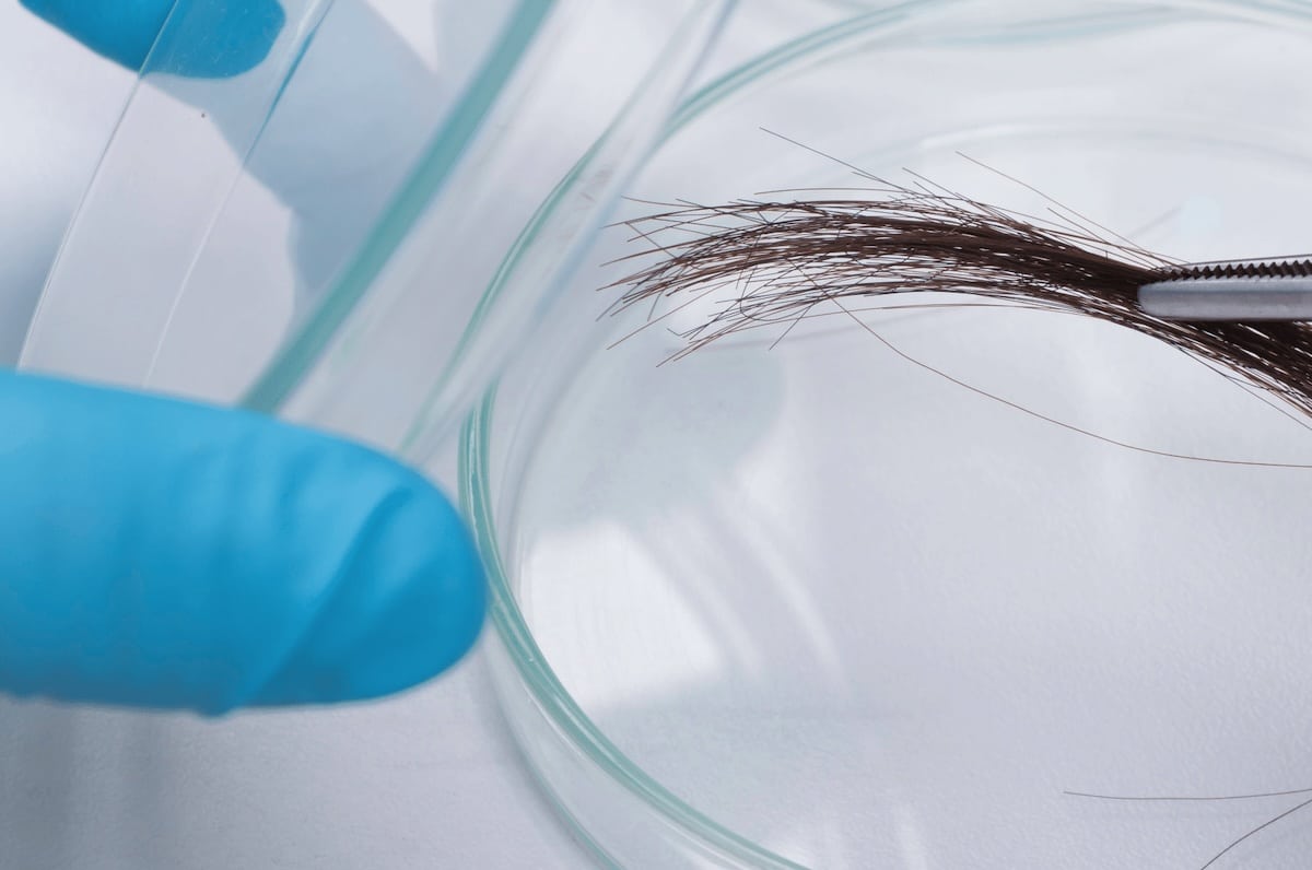 Putting hair sample on a petri dish for an epigenetic hair test