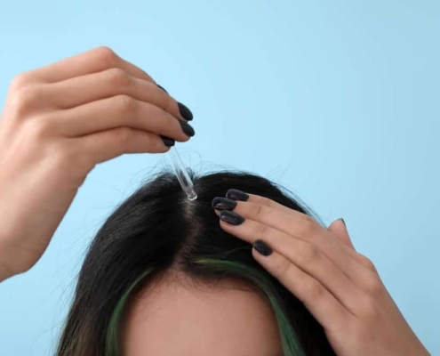 Does Finasteride, Minoxidil, Tretinoin Cure Hair Loss?
