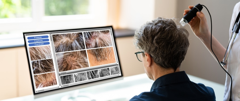 August is National Hair Loss Awareness Month, and during this time, a woman is carefully examining her hair on a computer screen.