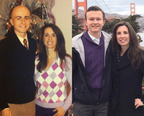 Photo of Will Siskey diagnosed with alopecia areata treatment before and after