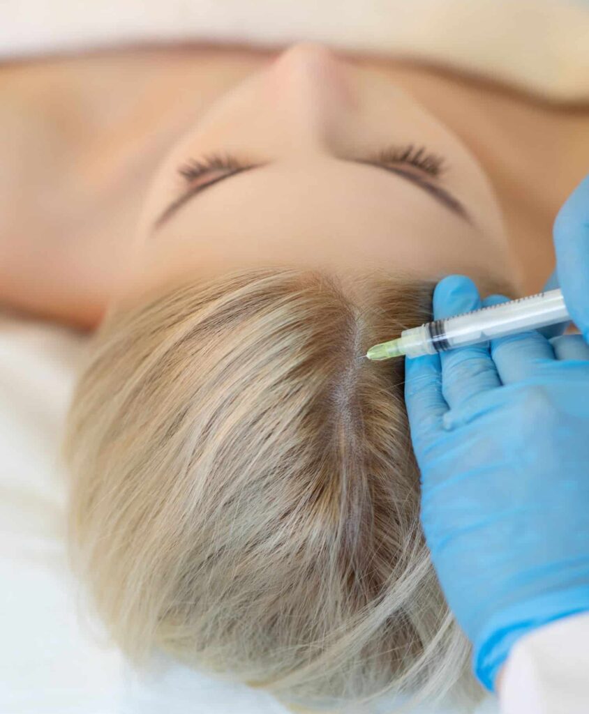 Doctor injecting on a patient's scalp for Platelet-rich plasma therapy for hair loss