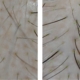 Alma TED technology for hair restoration results density