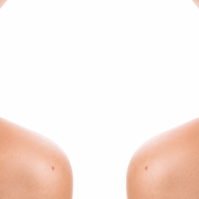 scar revision before and after