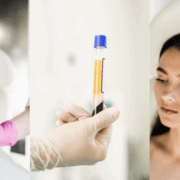 platelet-rich-plasma-prp-therapy