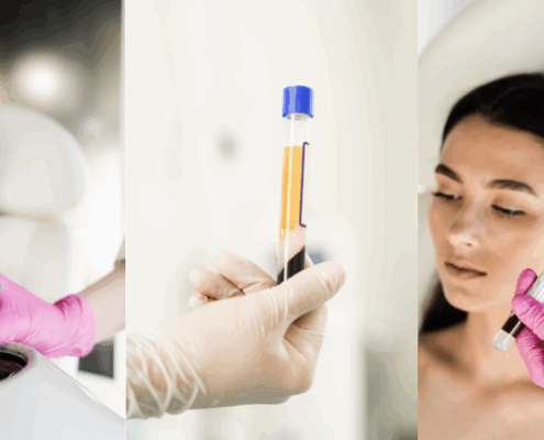 platelet-rich-plasma-prp-therapy