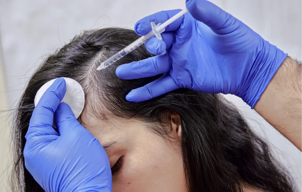 Exosomes & Hair Regrowth