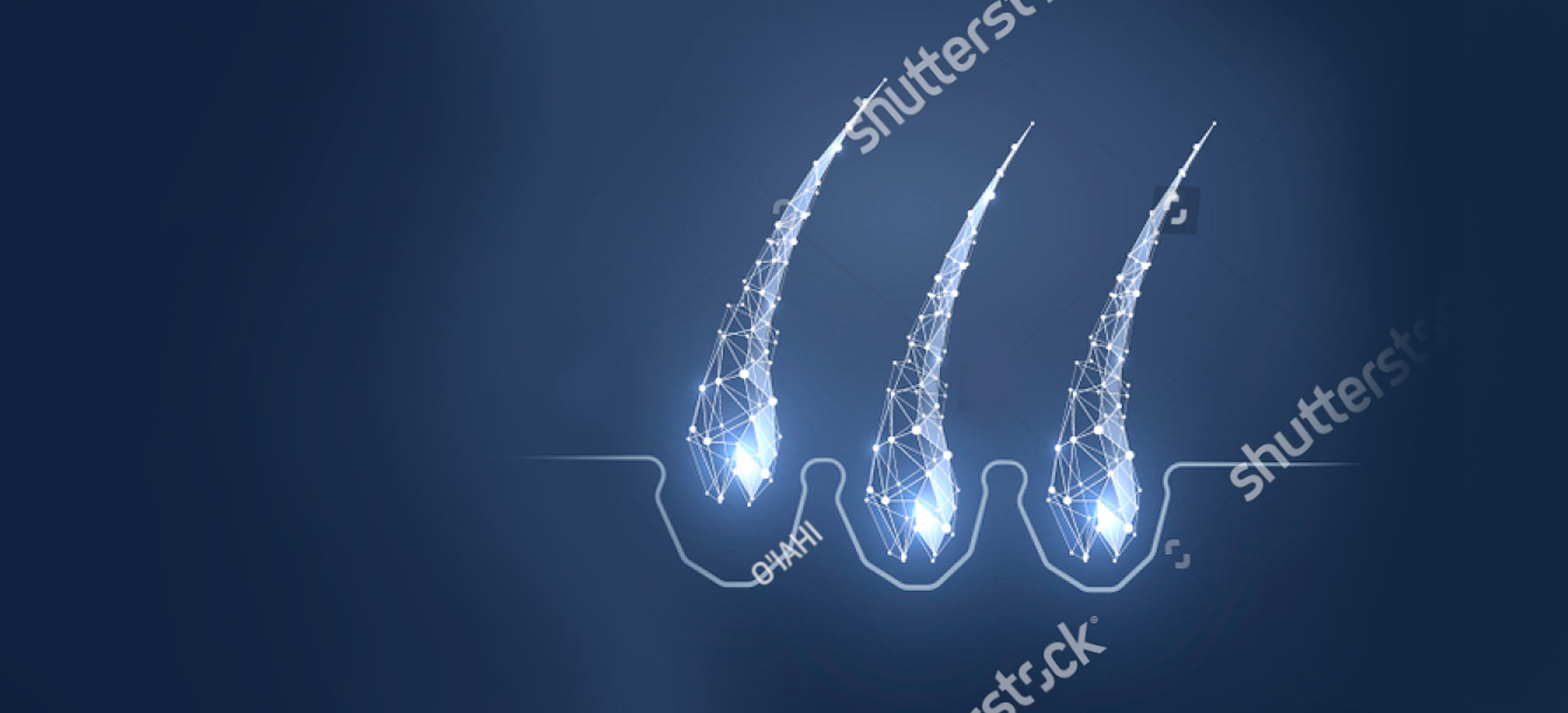 subpageheader_hairtransplant