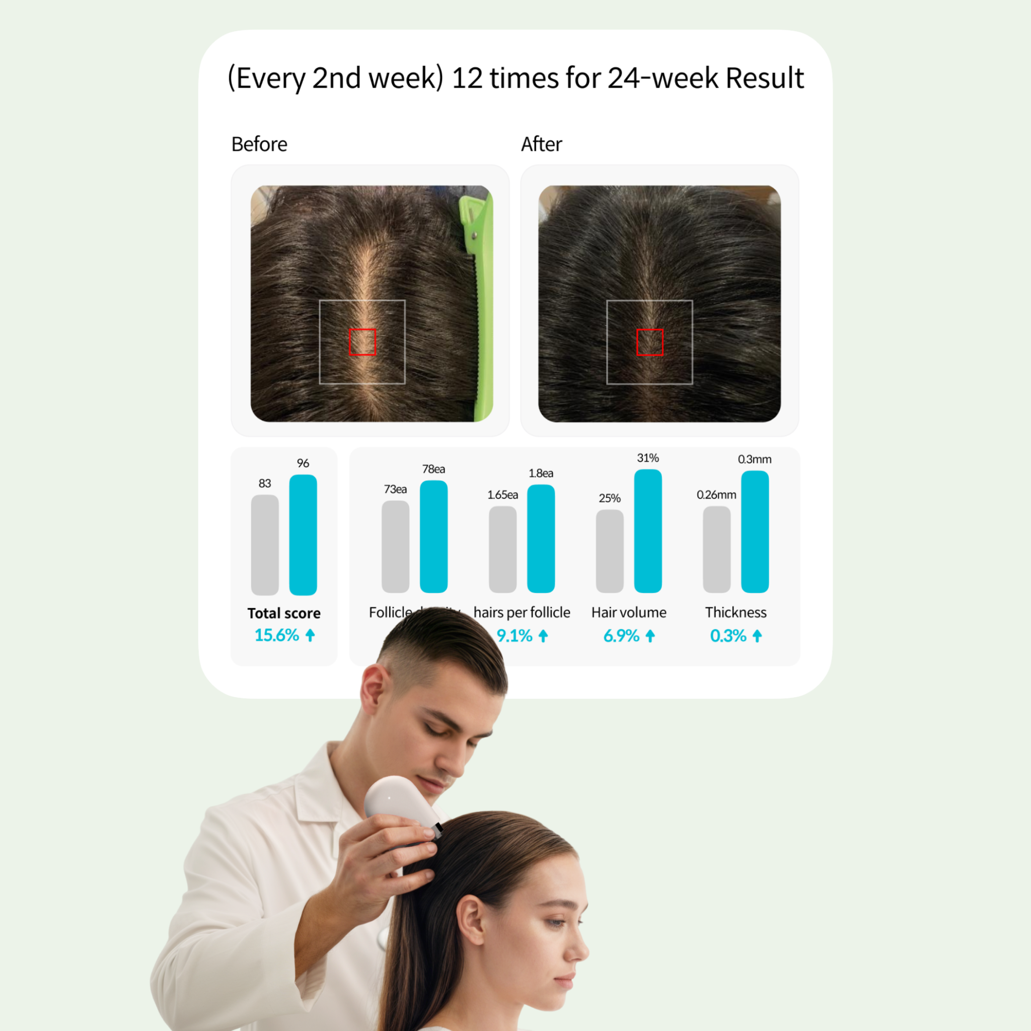 Beacon AI Hair Analysis Results