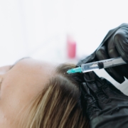 Hair Loss Trends Explained