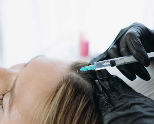 Hair Loss Trends Explained