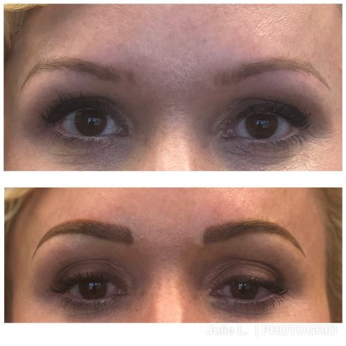 Before and after pictures showcasing a woman's brow enhancement.
