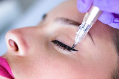 A woman receiving brow enhancement with a syringe.