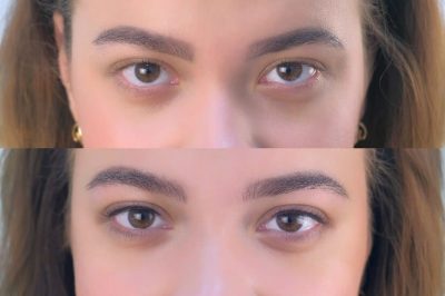Before and after pictures of a woman's eyes showcasing brow enhancement.